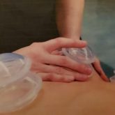cupping-1